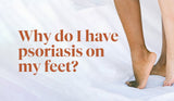 Why Do I Have Psoriasis on My Feet?
