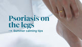 How to Calm Psoriasis on the Legs This Summer