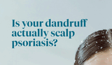 Is Your Dandruff Actually Scalp Psoriasis?