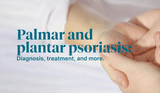 Palmar and Plantar Psoriasis: Diagnosis, Treatment, and More