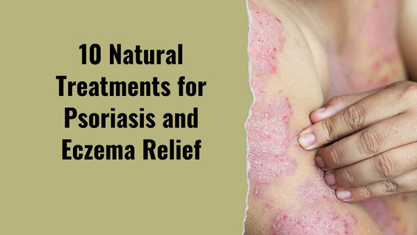 Natural Treatment and Medication Options for Psoriasis
