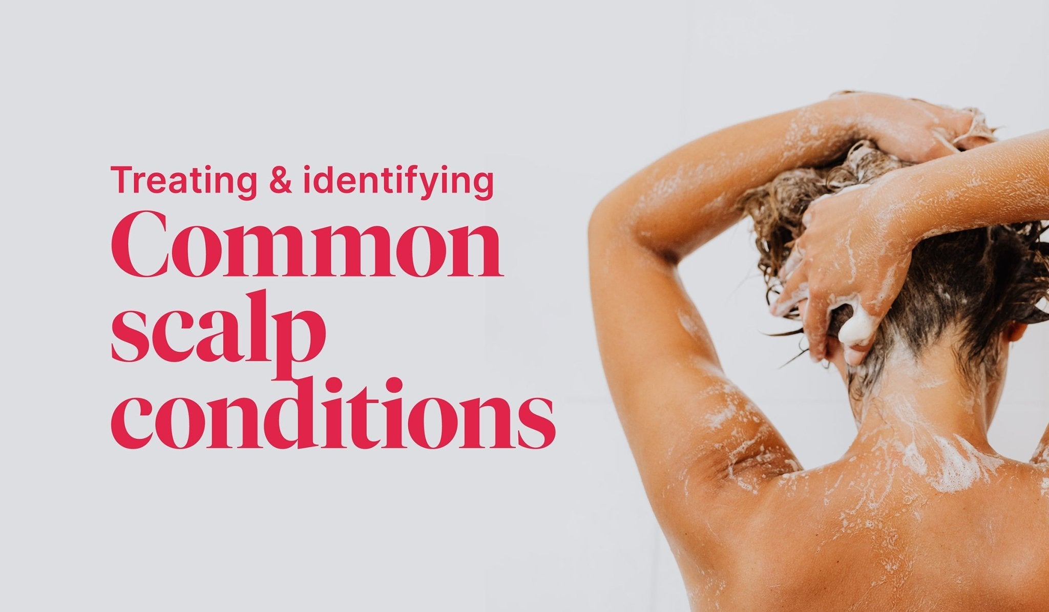 Dry, Itchy Scalp Conditions: Tips and Solutions – Hanna Sillitoe
