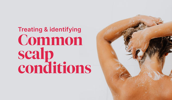 Scalp Conditions: Identifying and Treating Common Problems