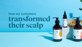 Experience the Difference: Customers Who Transformed Their Scalp with Our Oil