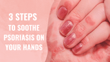 3 Steps  To Soothe Psoriasis On Your Hands
