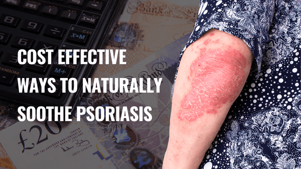Cost Effective Ways to Naturally Soothe Psoriasis