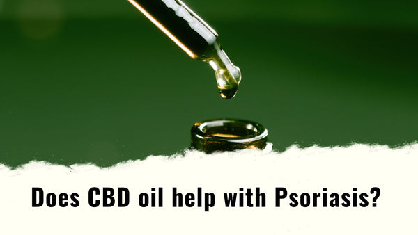 Does CBD oil help with Psoriasis?