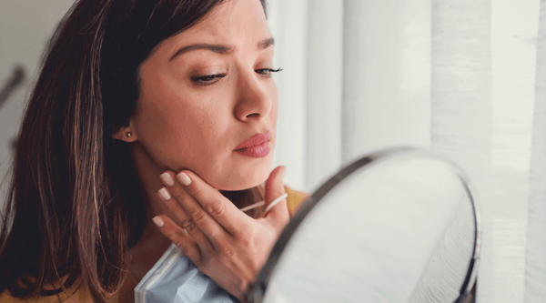 Maskne (mask acne) Treatment