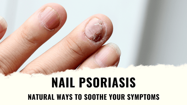 Nail Psoriasis - Natural Ways to Soothe Your Symptoms