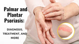 Palmar and Plantar Psoriasis: Diagnosis, Treatment, and More