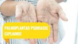 Palmoplantar Psoriasis Explained