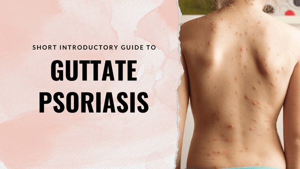 Short Introductory Guide to Guttate Psoriasis