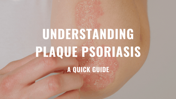 Understanding Plaque Psoriasis