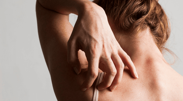 How to Soothe Skin Naturally - Hanna Sillitoe