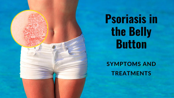 Psoriasis in Belly Button: Symptoms and Treatments