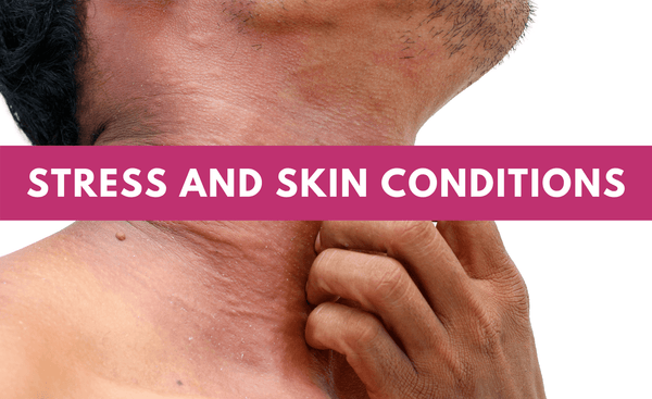 Can Stress Make Skin Conditions Worse?